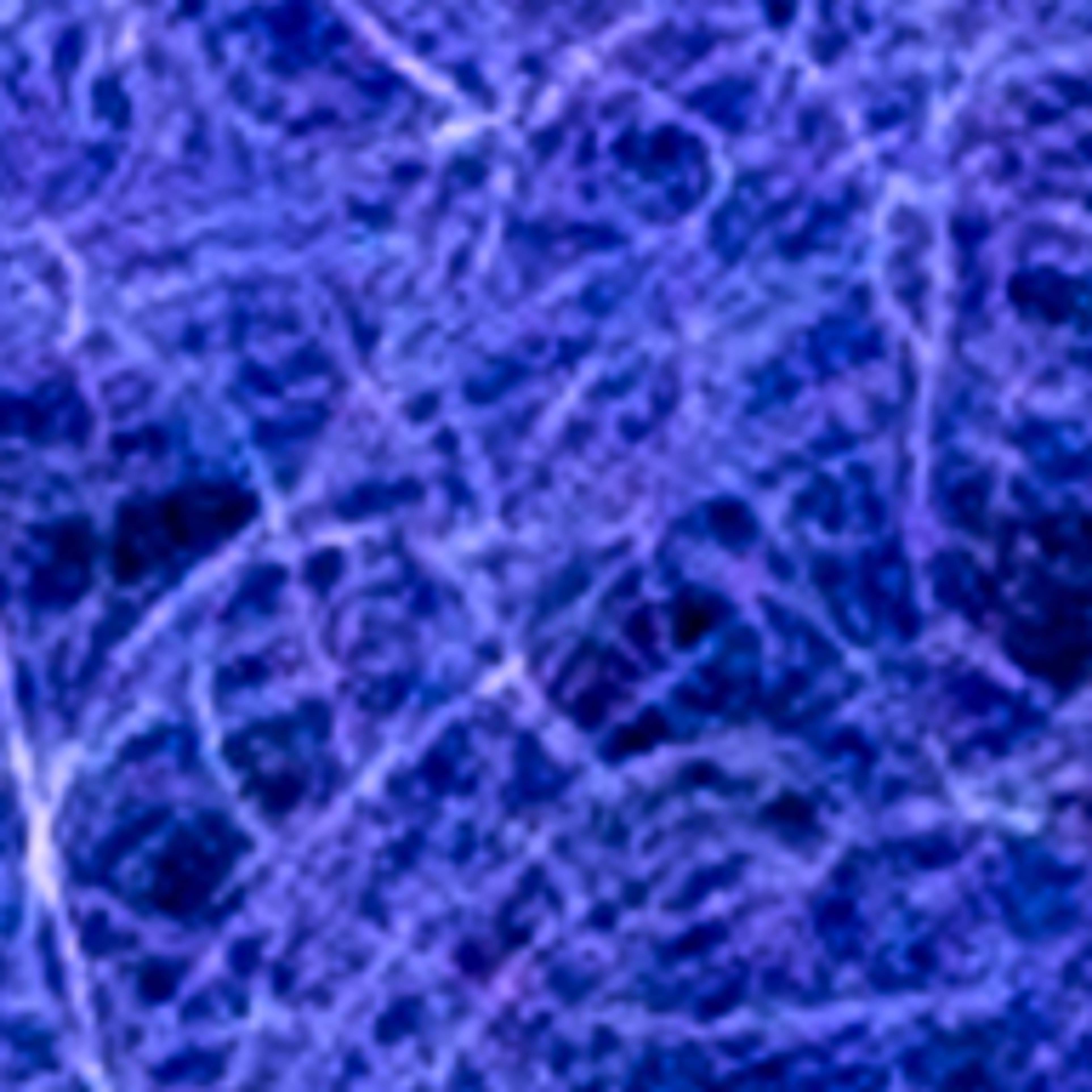 Variant thumbnail