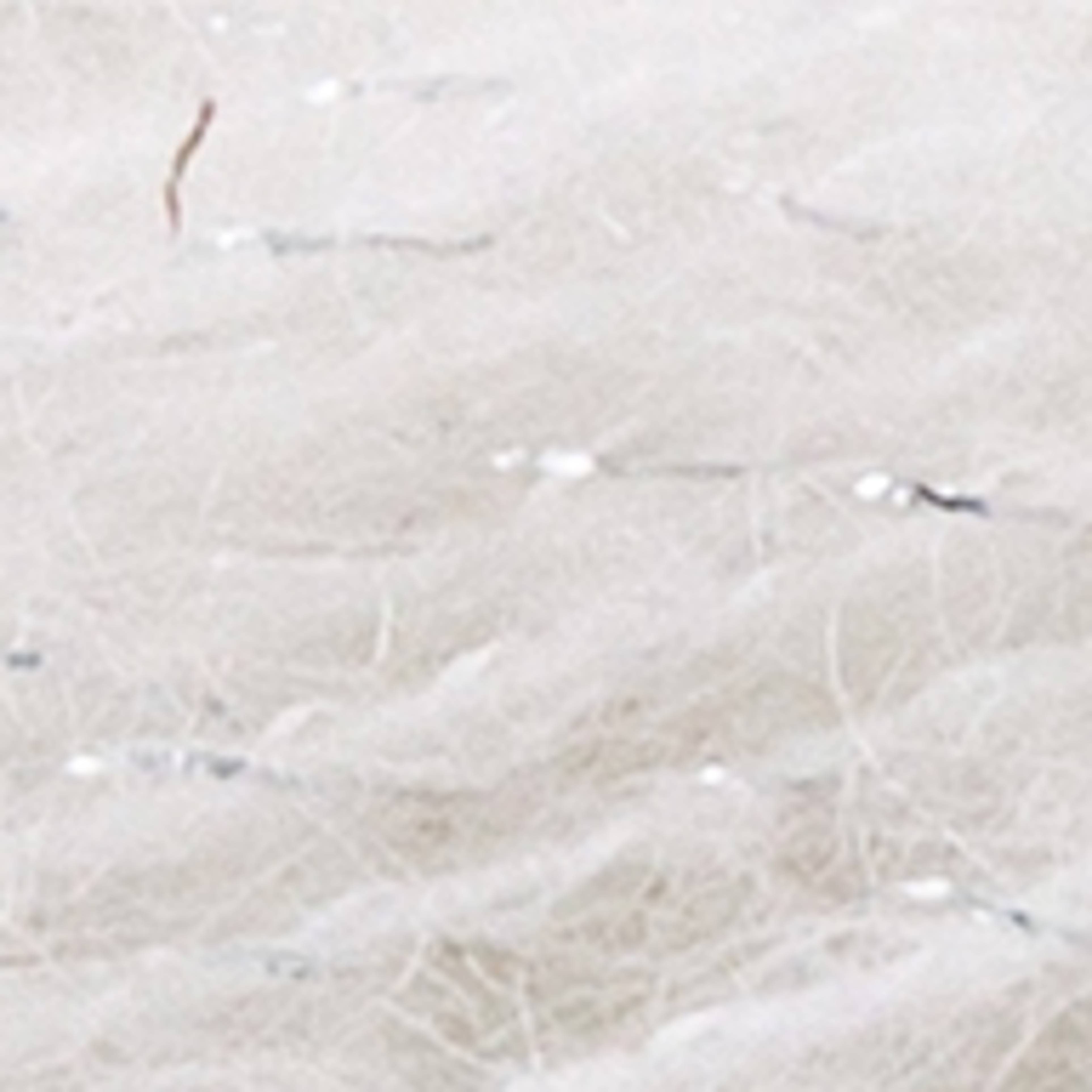 Variant thumbnail