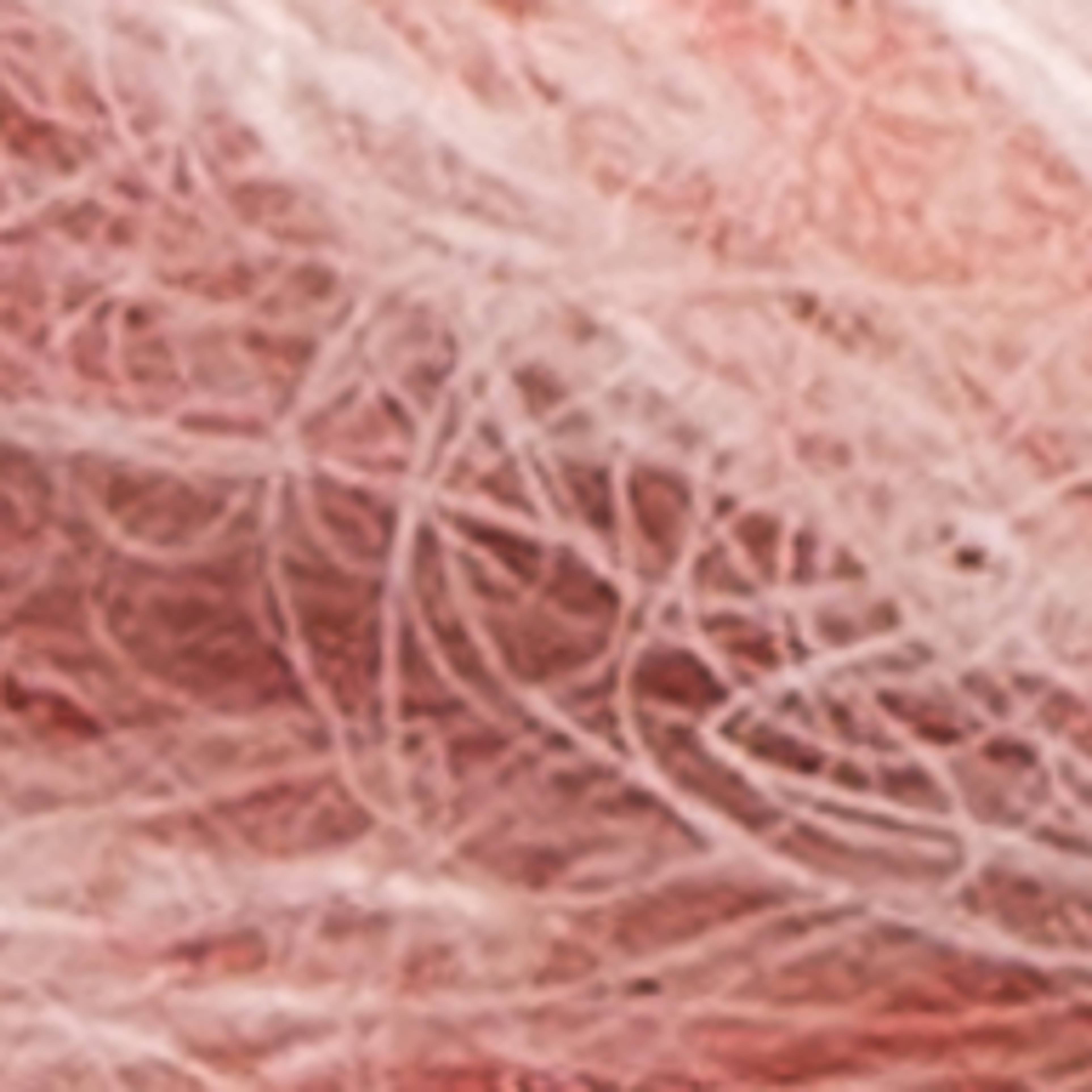 Variant thumbnail