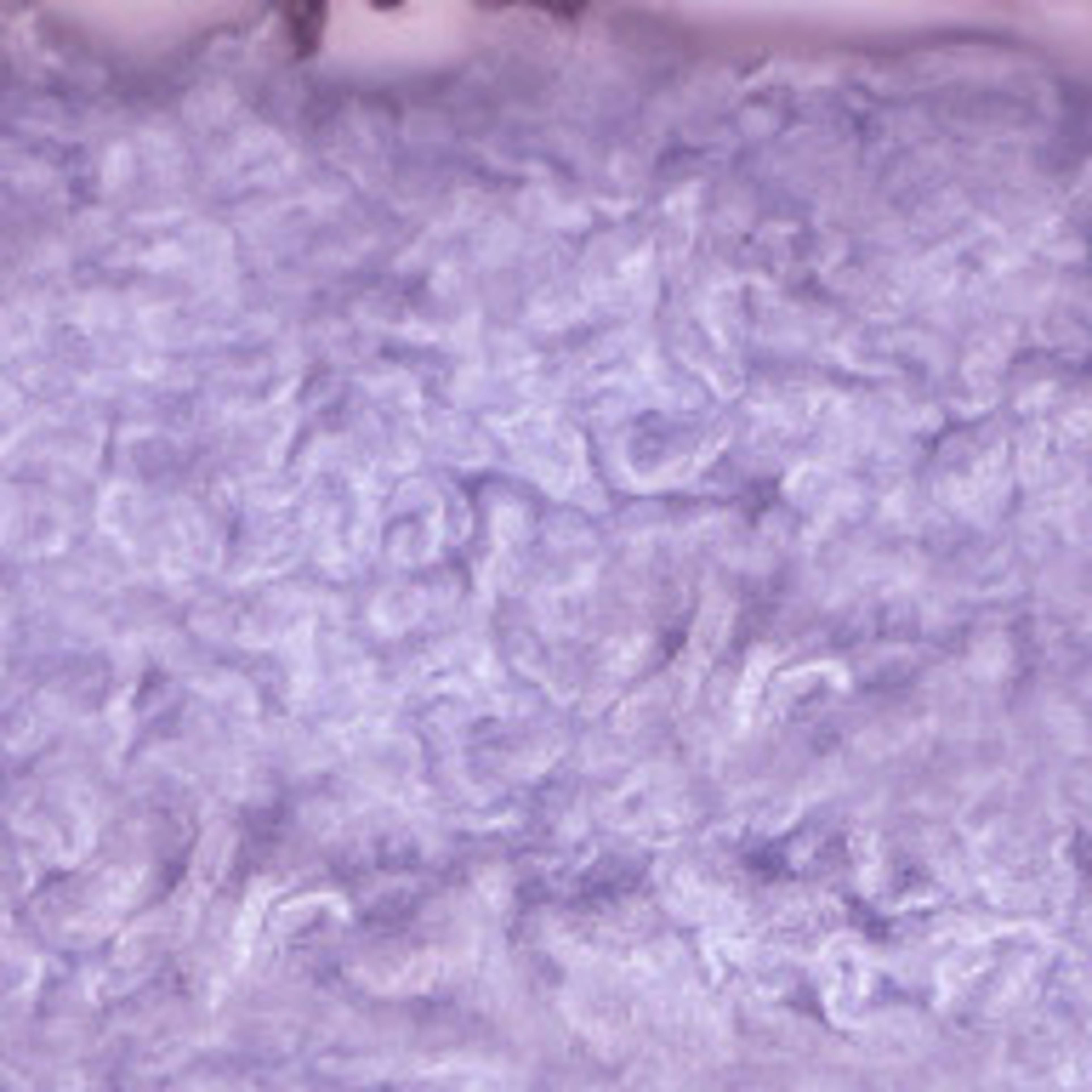 Variant thumbnail