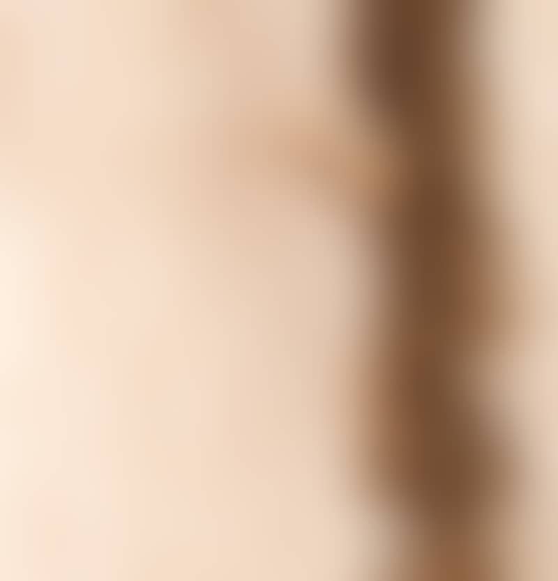 Image de la variation